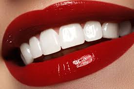 dentes com facetas