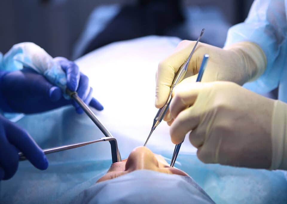 procedimento de enxerto ósseo para implante dentário
