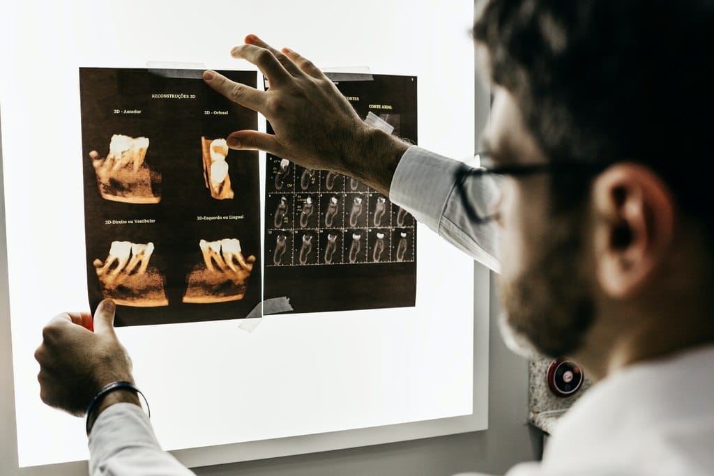 odontologista examinando raio x de enxerto ósseo para implante dentário