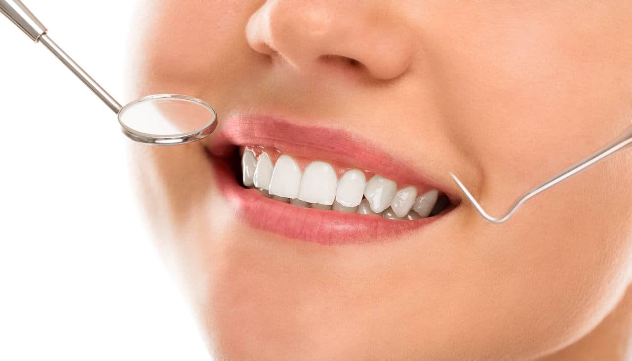 dentes de porcelana e suas vantagens